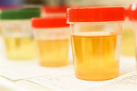 Types Of Urine Tests Lab Testing API