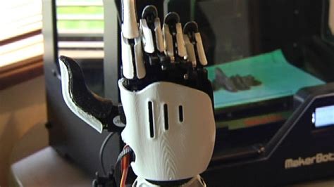 Bionic Arm 3d Printing And No 8 Wire Newshub