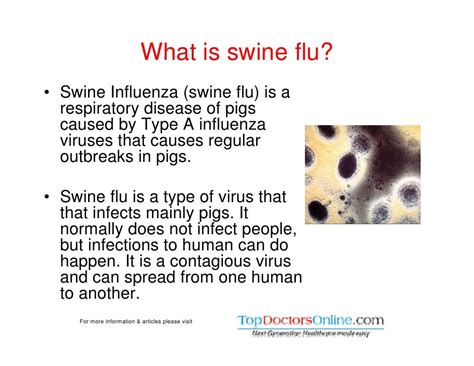 Swine Flu H1n1 Info Symptoms Prevention And Treatment