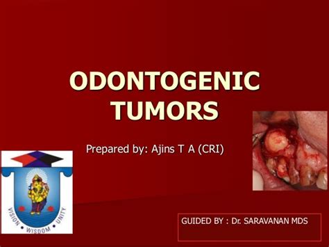 Benign Odontogenic Tumors In Oral Cavitty