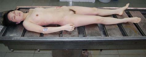 Young Asian Woman In Morgue - Best Gore Free Download Nude P.