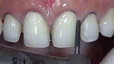 Simple Science: How to Make a Volcano with Kids