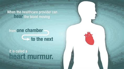 Dangers Of Heart Murmur Do You Need To Worry Heart Murmur What Is