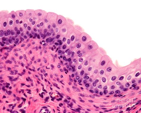 Urinary Bladder Transitional Epithelium Photograph By Jose Calvo Science Photo Library Pixels