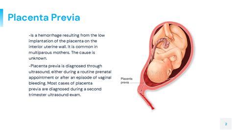 Top Placenta Accreta Animation Merkantilaklubben Org