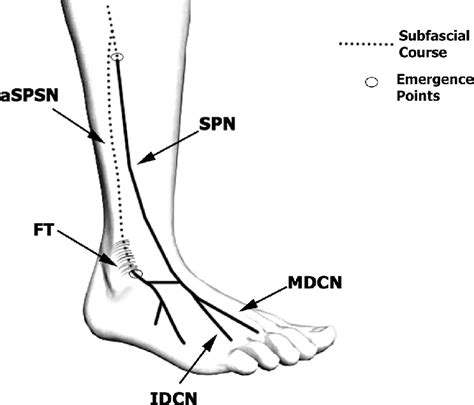 Schematic Demonstration Of The Accessory Superficial Peroneal Sensory