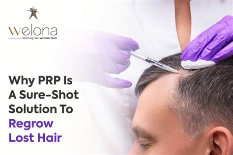 Why Prp Is A Sure Shot Solution To Regrow Lost Hair