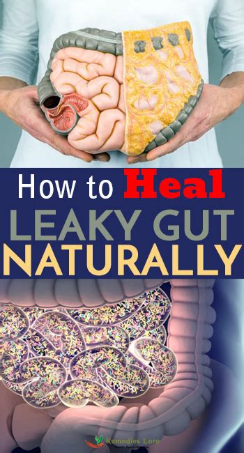 How To Heal Leaky Gut Naturally Remedies Lore
