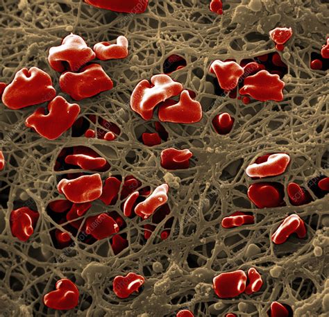 Blood Clot Stock Image C0085084 Science Photo Library