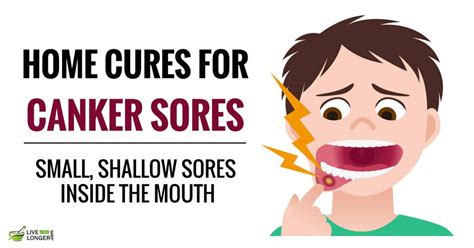 Canker Sores Are Tiny Red Bumps That Appear Inside The Mouth On The
