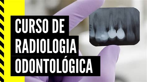 Curso De Radiologia Odontológica Youtube