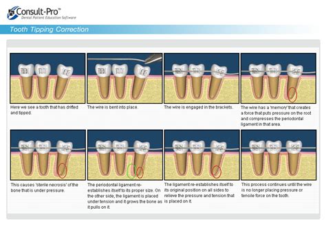 Dental Care Bangkok Asavanant Dental Care Clinic In Bangkok Thailand