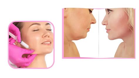 How To Reduce Double Chin Best Tips For You To Know