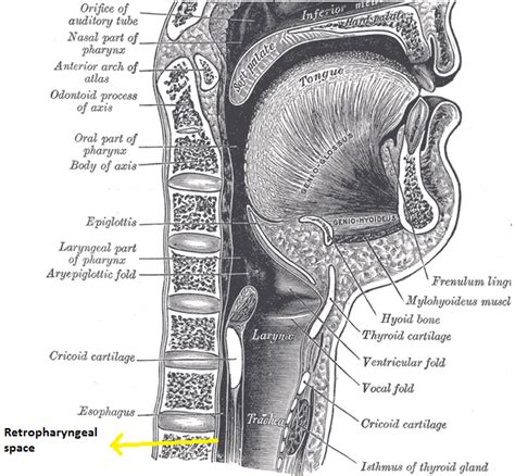 Retropharyngeal Abscess Wikidoc
