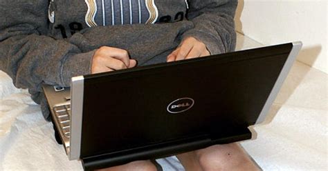 Laptop On Bare Skin Can Cause Toasted Skin Syndrome Ny Daily News