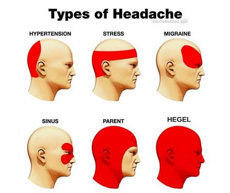 Dehydration Headache Chart My XXX Hot Girl