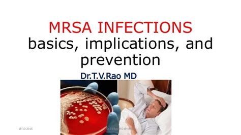 Mrsa Infections Basics Implications And Prevention