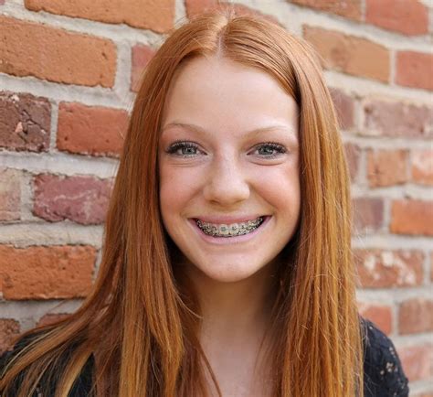 A Young Woman With Braces On Her Teeth Smiles At The Camera While Standing In Front Of A Brick Wall