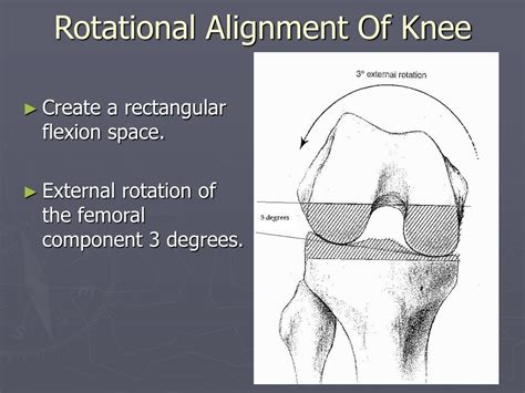 Ppt Total Knee Arthroplasty Powerpoint Presentation Free Download