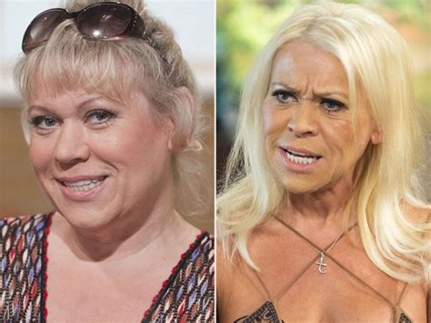 Has Dramatic Weight Loss Dramatically Aged These Stars
