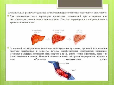 Печеночная недостаточность - презентация онлайн Картинка - Печеночная недостаточность - презентация онлайн