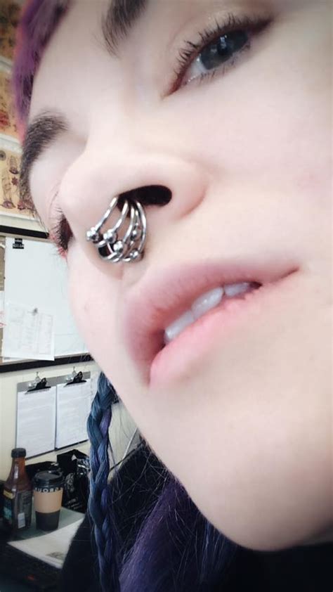 multiple rings in stretched septum r stretched