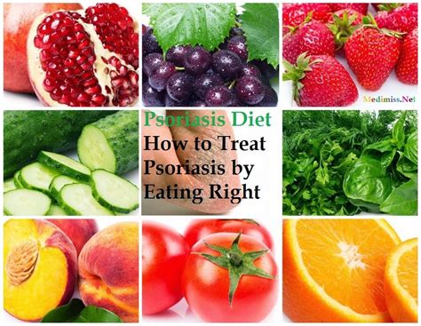 Psoriasis Diet How To Treat Psoriasis By Eating Right Psoriasis