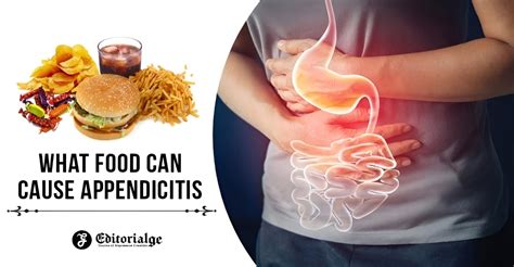 What Food Can Cause Appendicitis Foods You Should Avoid