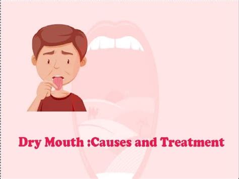 Dry Mouth Causes And Treatment Youtube