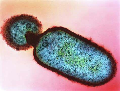 Listeria Monocytogenes Bacteria Photograph By Dr Kari Lounatmaascience