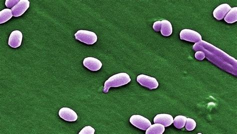 Pentagon Poor Testing Led To Army Shipping Live Anthrax