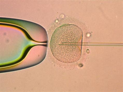 Pma Filiation Embryons Vers Les Réformes En Profondeur Sciences Et