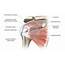 Questions About Shoulder Pain Due To Rotator Cuff Disease Answered By 