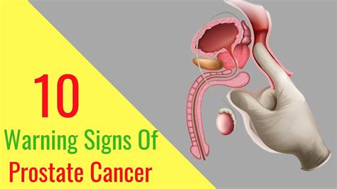 Prostate Cancer Symptoms Warning Signs Of Prostate Cancer You Should Not Ignore YouTube