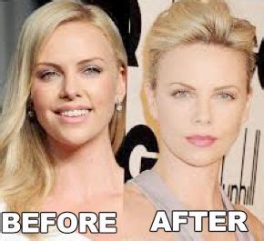 Celebrity Charlize Theron Plastic Surgery Before After Celebrity