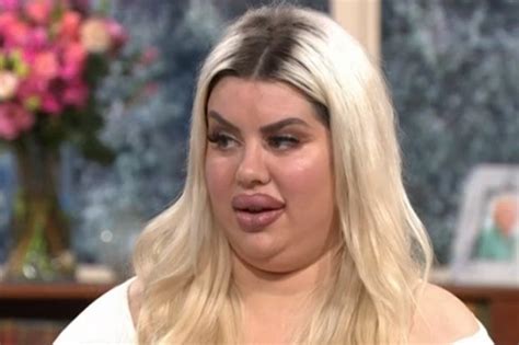 Model Aspiring To Get The Worlds Biggest Bum Eats 6000 Calories A Day For Her Sizeable Booty