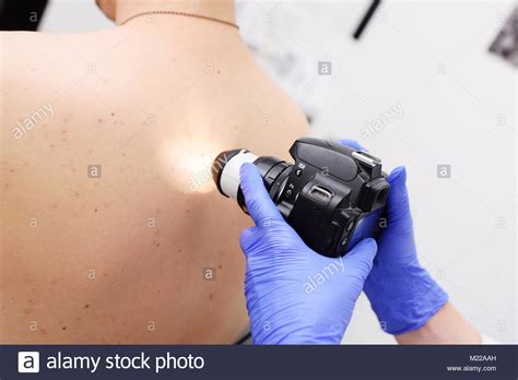 Preventing Melanoma And Skin Cancer Stock Photo Alamy