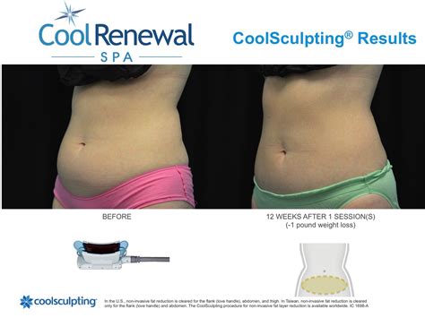 Before And After Cool Renewal Spa