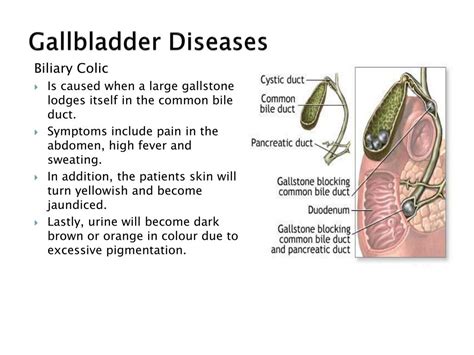 Ppt Structure And Function The Gallbladder Powerpoint Presentation Free Download Id
