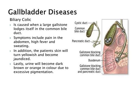 PPT Structure And Function The Gallbladder PowerPoint Presentation Free Download ID