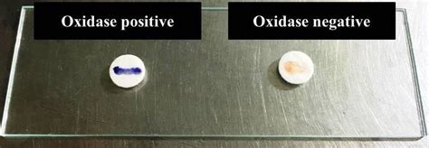 Oxidase Test Showing Oxidase Positive Left Side And Oxidase Negative Download Scientific