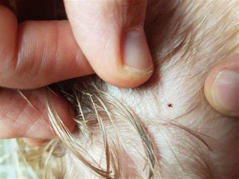 Mums Lyme Disease Warning After Son Got Tick Bite At National Trust