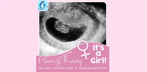 The Ramzi Theory Can Predict Babys Gender As Early As 6 Weeks The