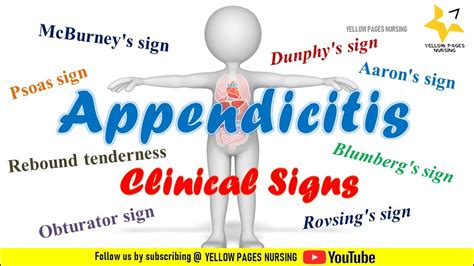 Clinical Signs Of Appendicitis Nclex Review Youtube