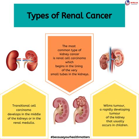 Types Of Renal Cancer Infographics