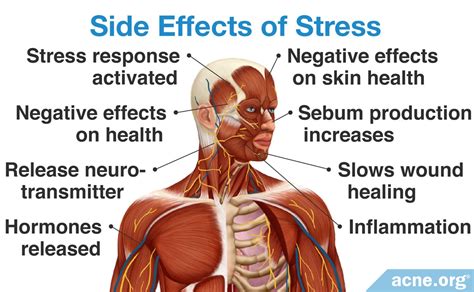 does stress affect acne