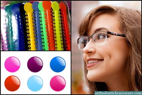 Best Braces Colors For Girls How To Choose Orthodontic Braces Care