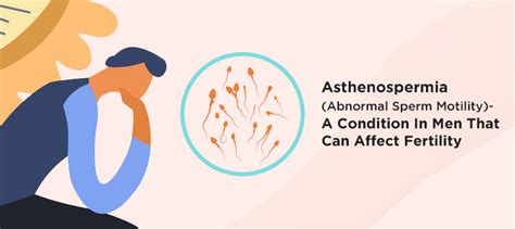 Asthenospermia Infertility Condition In Men That Can Affect Fertility