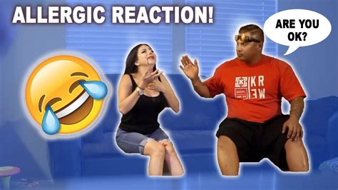 Deadly Allergic Reaction Prank Youtube