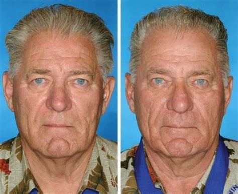 What 7 Smoker Vs Nonsmoker Identical Twins Look Like After Many Years